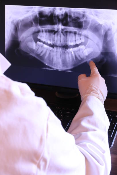Best Knocked-Out Tooth (Avulsed Tooth) Treatment in Wilson Conococheague, MD